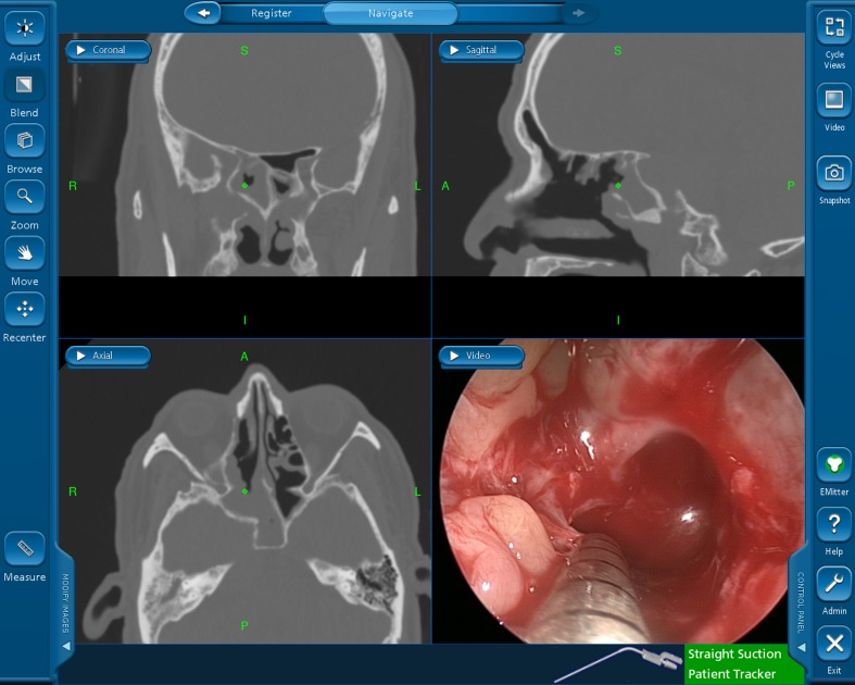 Fig 1