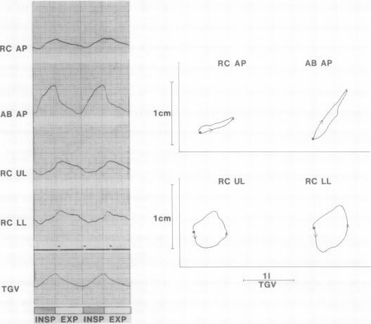 graphic file with name thorax00220-0026-a.jpg