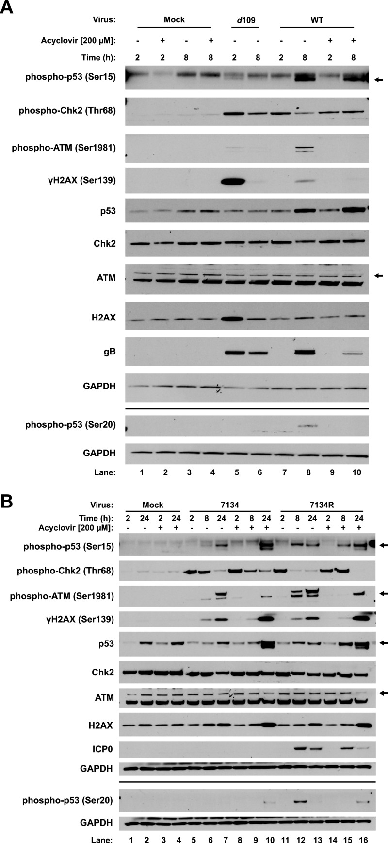 FIG 1