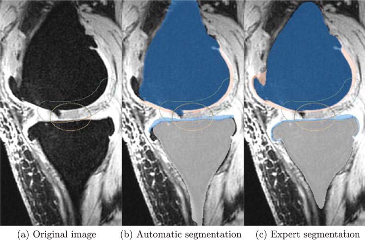 Fig. 21