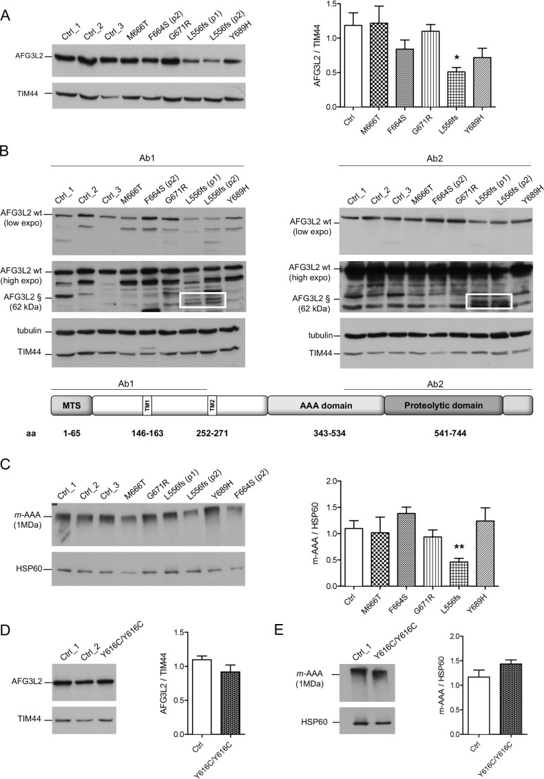 Pathogenic variants in the AFG3L2 proteolytic domain cause SCA28 ...