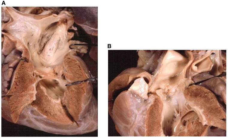 Figure 15