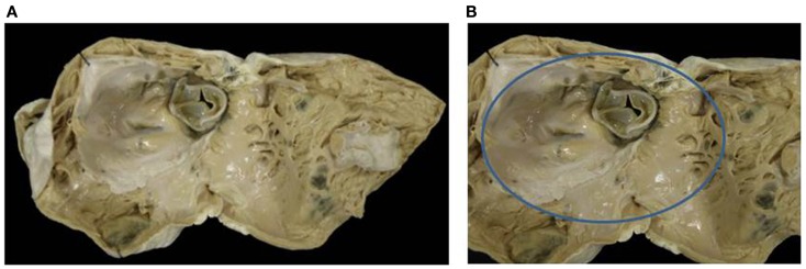 Figure 14