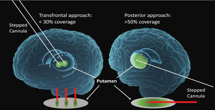 Fig.1