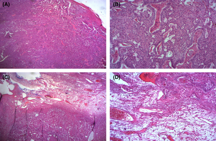 FIGURE 2