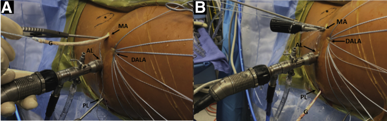 Fig 4