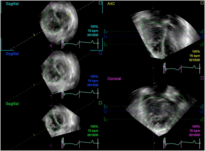 Figure 4