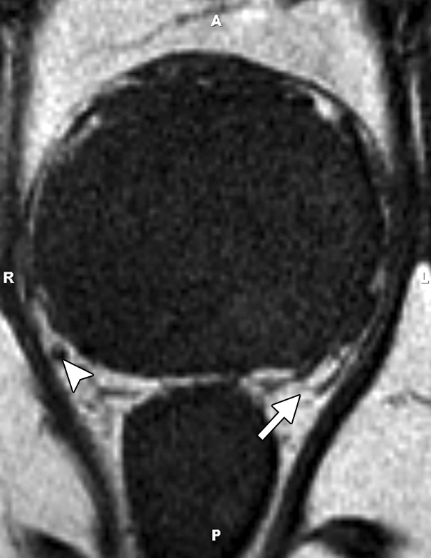 Figure 7c