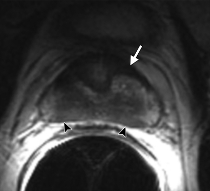 Figure 2b