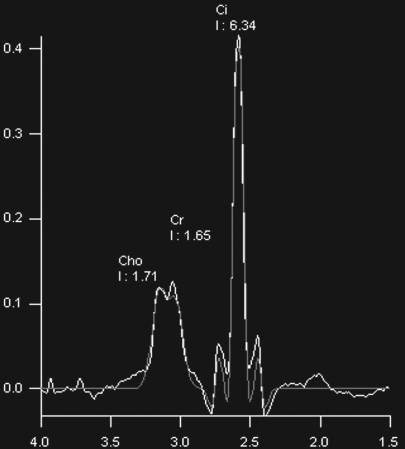 Figure 9c