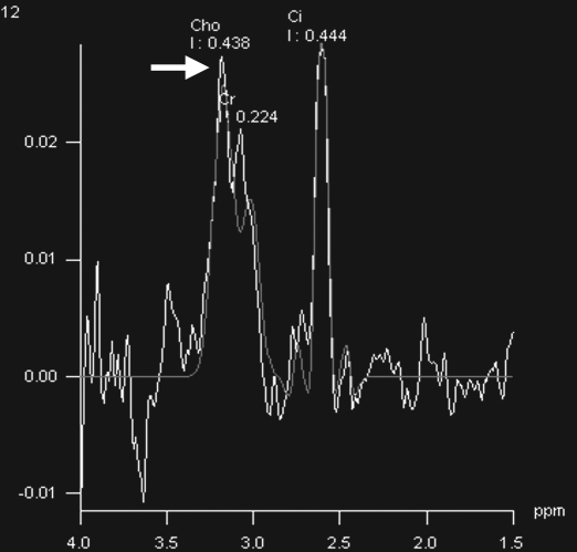 Figure 5b