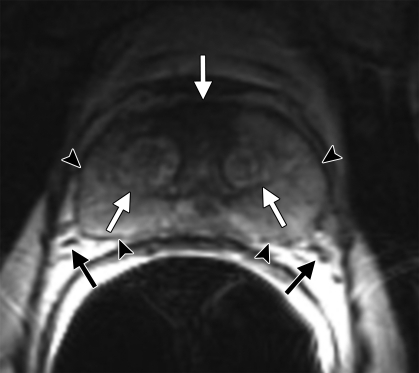 Figure 2c