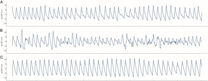 FIG. 3.