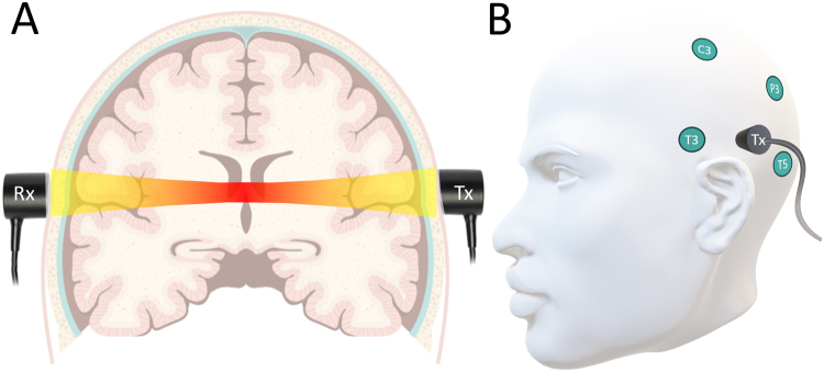 FIG. 1.