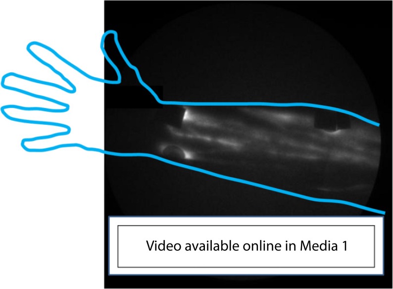 Fig. 3