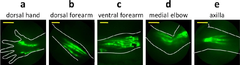 Fig. 2