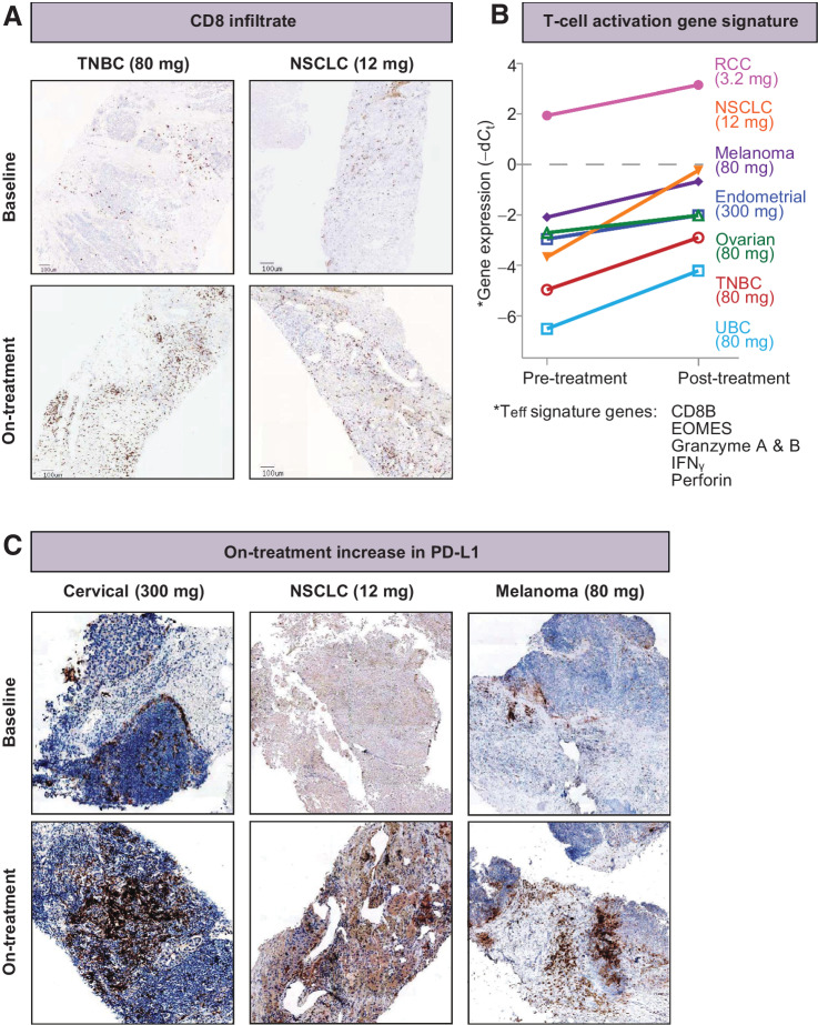 Figure 2. Immune activation in a subset of tumors consistent with effector T-cell co-stimulation. A, An increase in CD8 infiltrate following MOXR0916 treatment was observed. B, An increase in effector T-cell activation signature, comprised of CD8, EOMES, granzyme A&B, IFN gamma, and perforin, was observed. C, Increase in PD-L1 expression, as measured by IHC, is presumably reflective of adaptive upregulation downstream of IFNγ signaling.