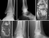 Fig. 3A–F