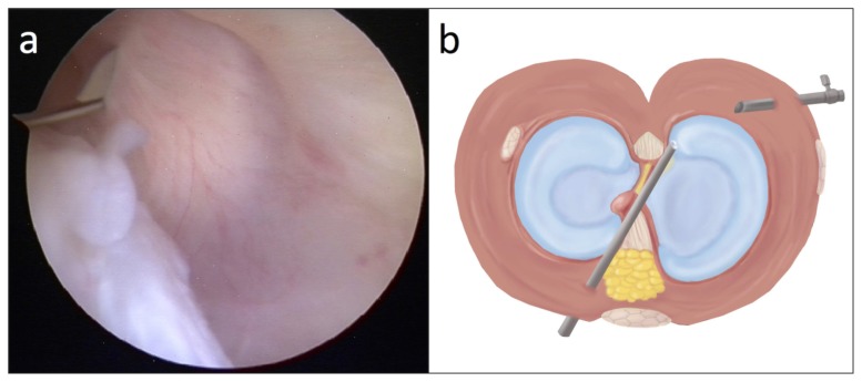 Figure 4 a, b