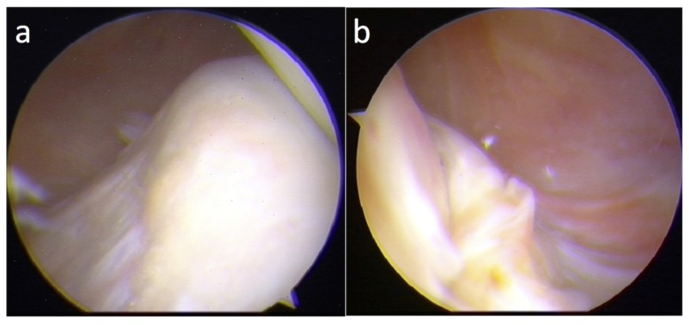 Figure 1 a, b