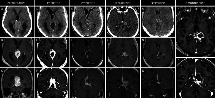 FIG. 4