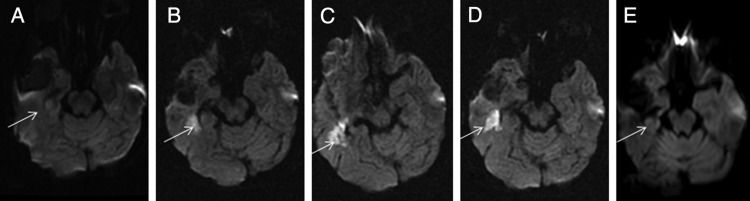 Fig. 2.