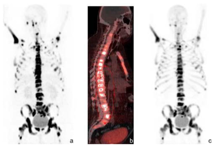 Fig 11