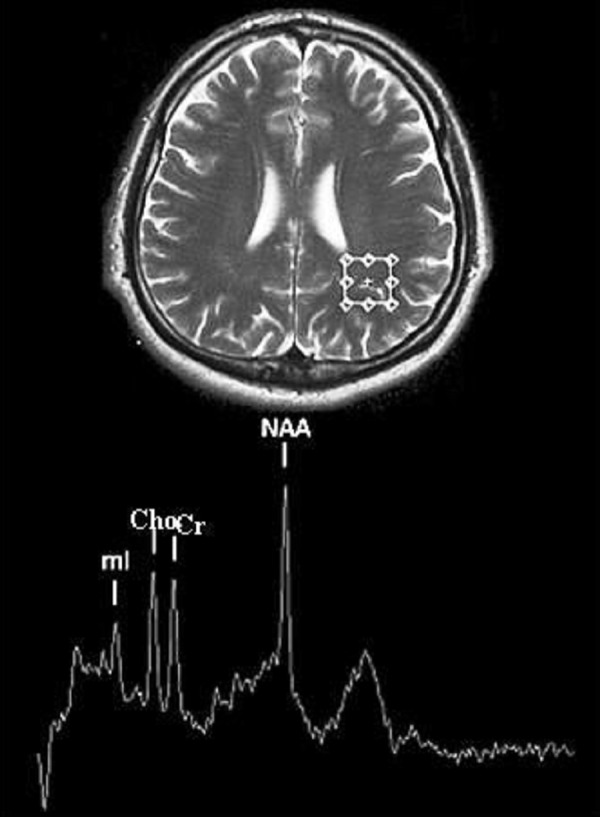 Figure 2.