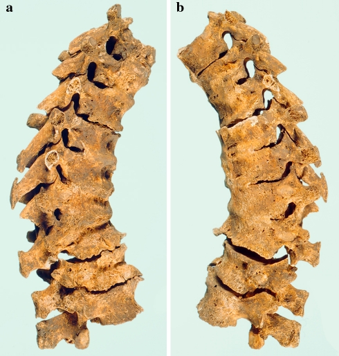 Fig. 3