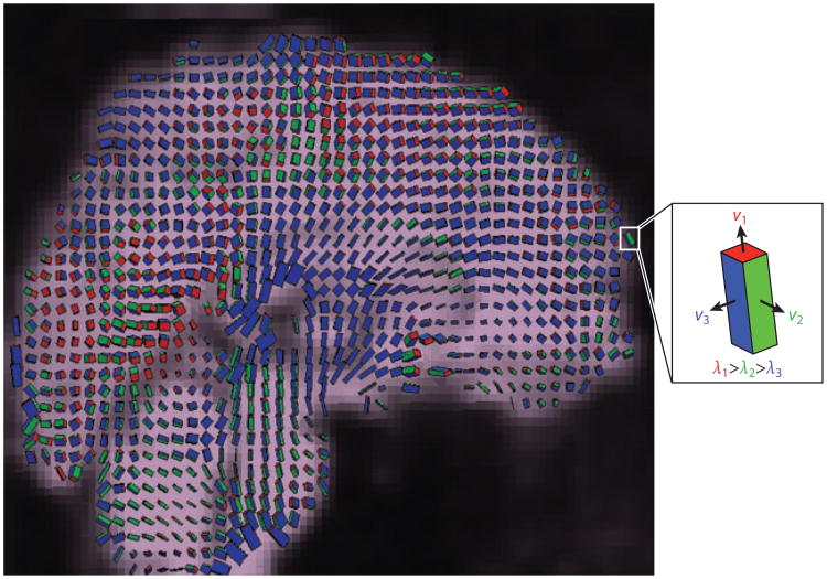 Figure 11