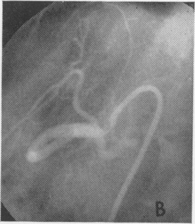 FIG. 10B