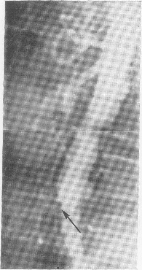 FIG. 8