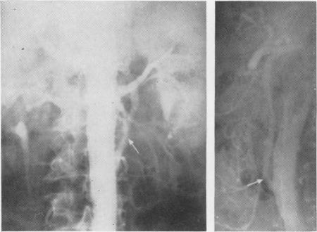 FIG. 10D and FIG. 10E