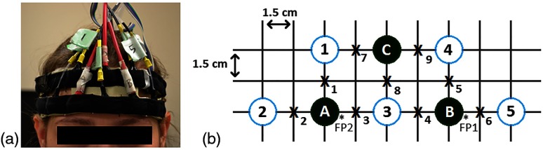 Fig. 1