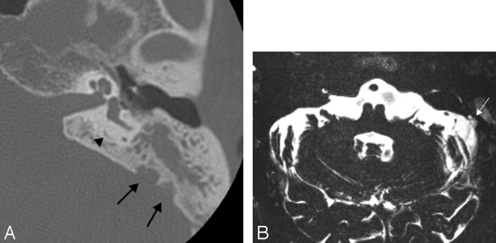 Fig 3.