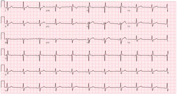 Figure 1