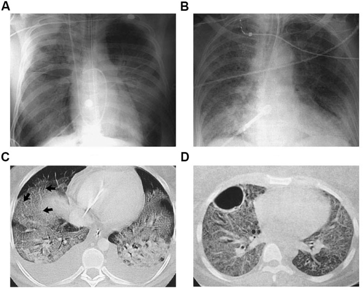 FIGURE 1