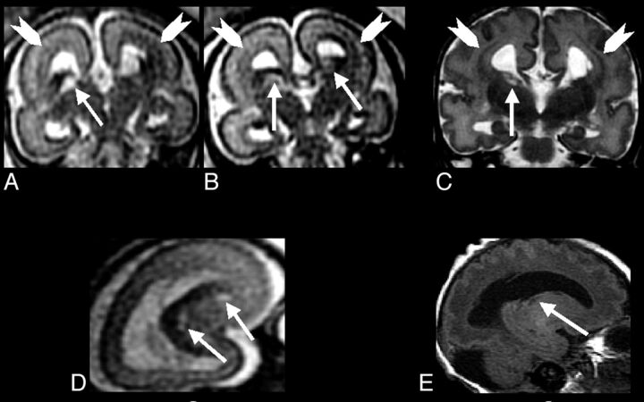 Fig 3.