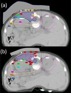 Figure 16