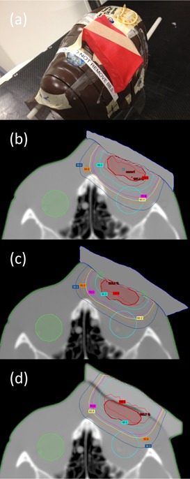 Figure 13