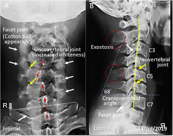 Fig 1