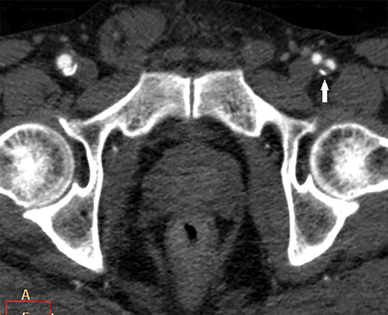 Fig. 5.