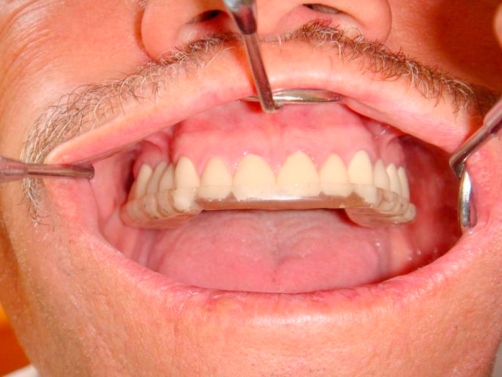 Figure 9.