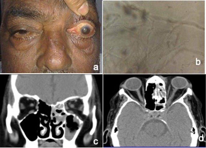 Fig. 1