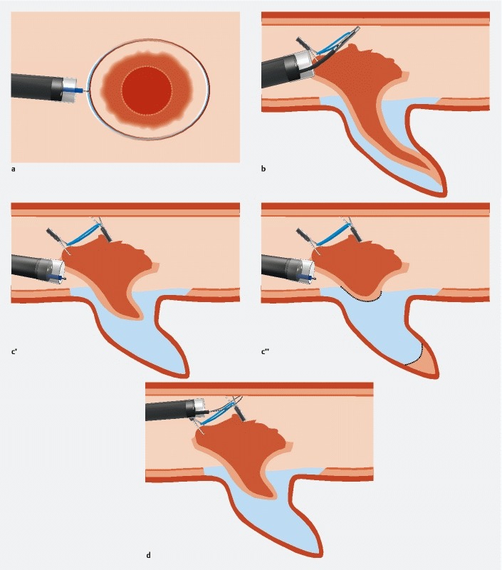 Fig. 3 