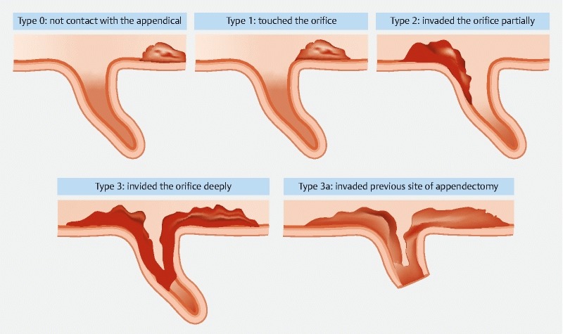 Fig. 2 