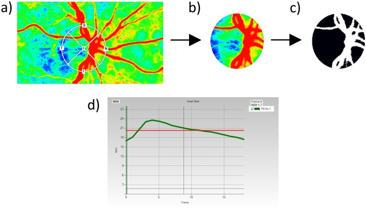 Fig 1