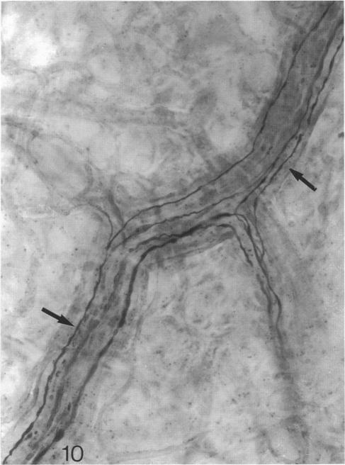 Fig. 10