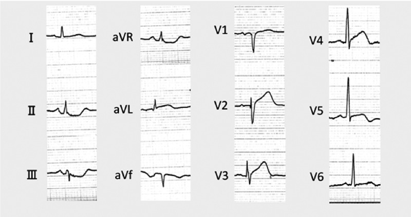 Figure 2.