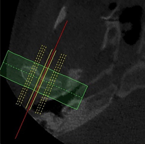 Figure1